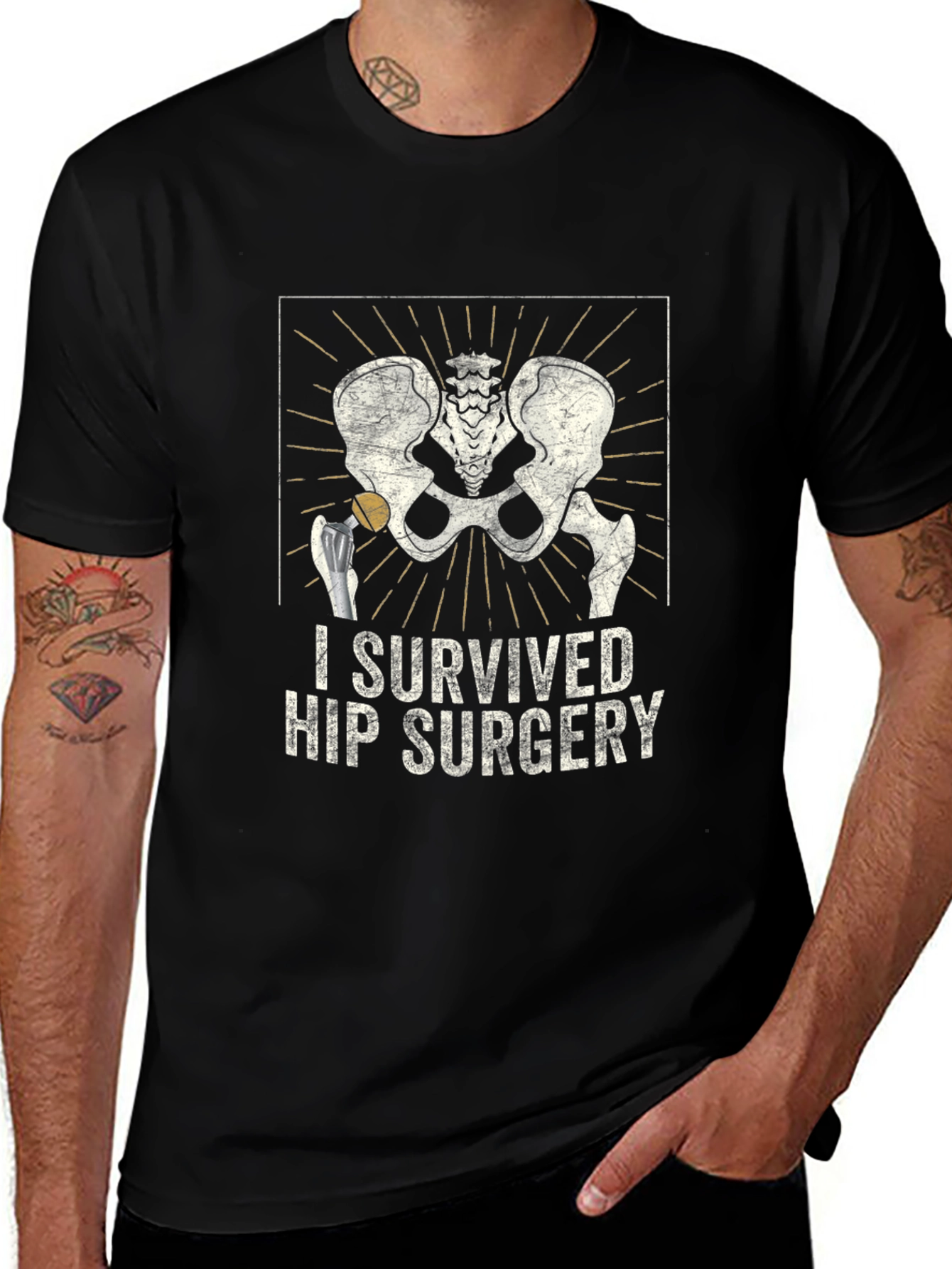 Hip Surgery Survivor Graphic Tee